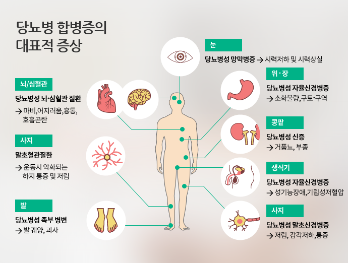 [성인간호학]#5 당뇨병의 만성합병증과 발관리 : 네이버 블로그